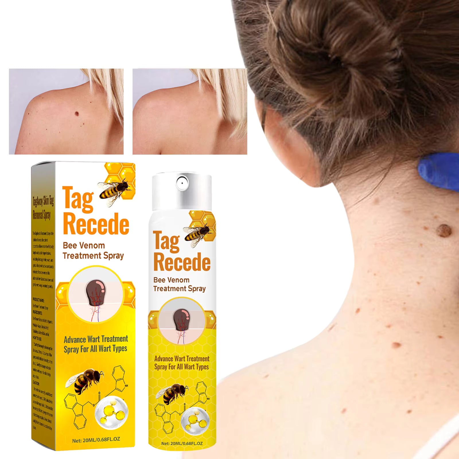 Tag Recede Bee Venom Repair Spray – Advanced Skin Repair & Tag Care Formula – Fast Absorbing Spray