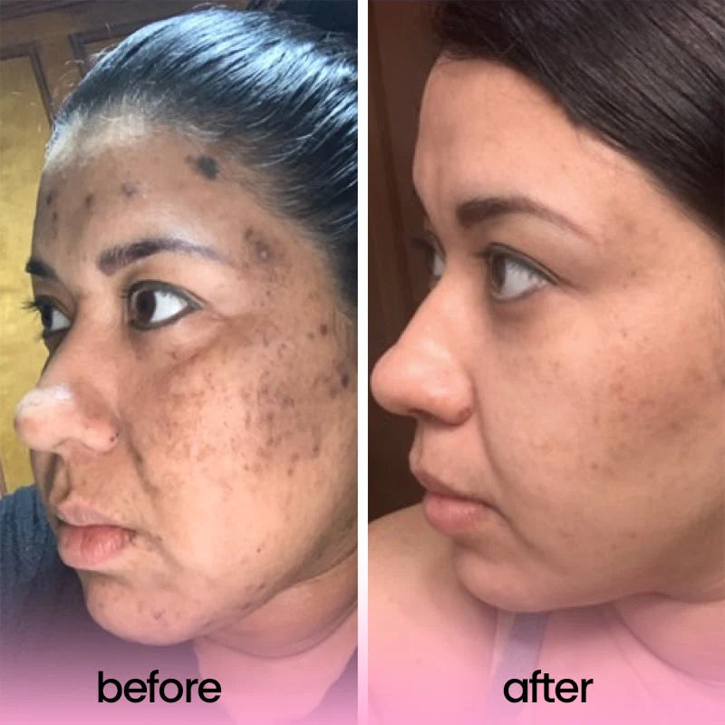 Turmeric Acid Cleaning Pads – Deep Clean & Exfoliating Skin Care Pads – Brighten, Smooth & Revive Skin